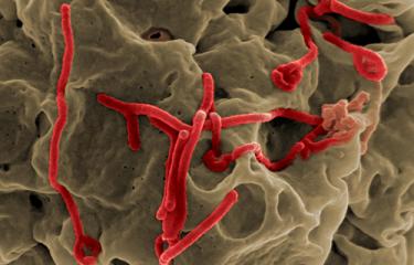 Allergens under microscope